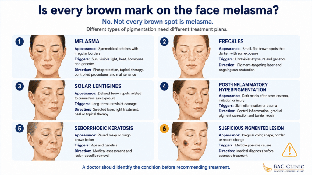 every brown mark on the face melasma?

No. Not every brown spot is melasma, and treating every type of pigmentation with the same device can produce disappointing results.