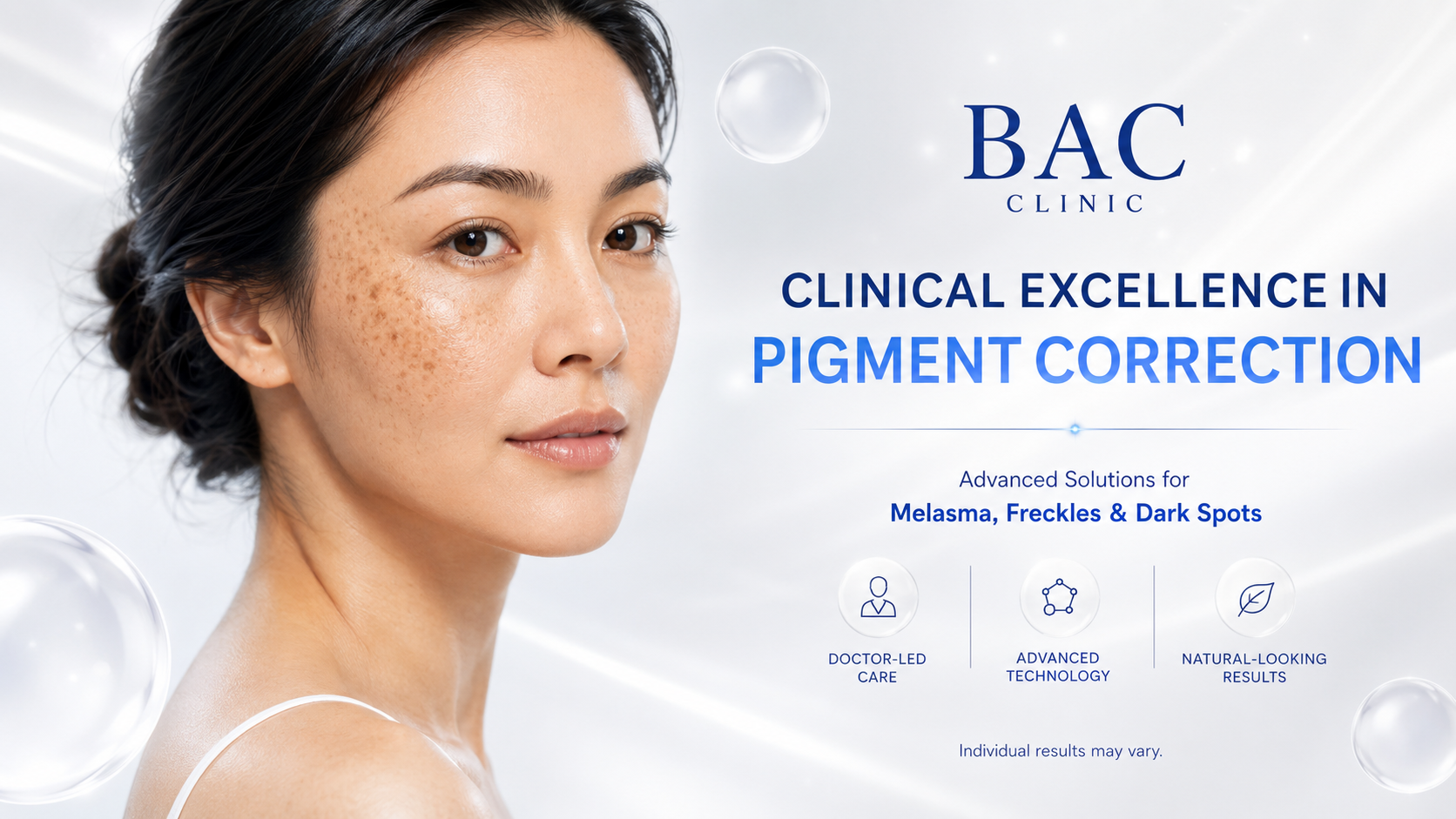 melasma treatment