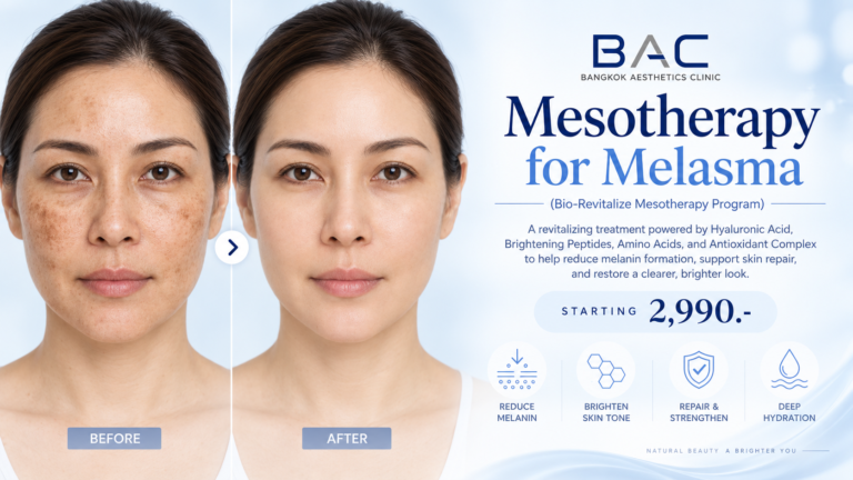 Mesotherapy for Melasma | BAC Clinic Bangkok, Thailand