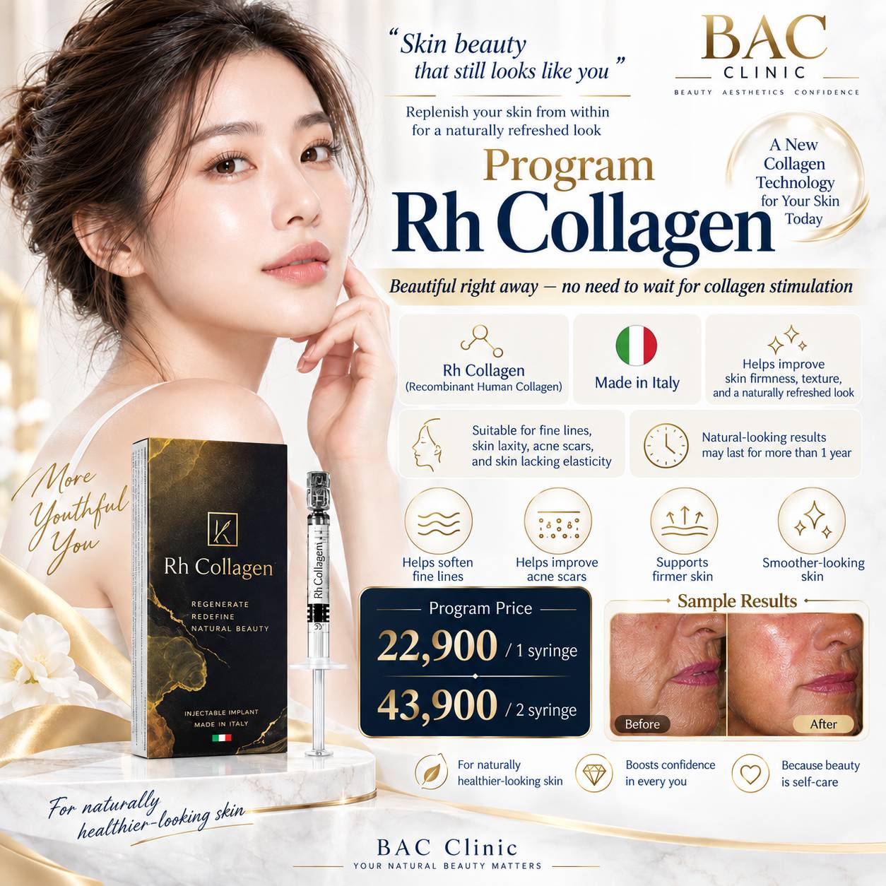 Acne Scar Revision BAC Clinic
