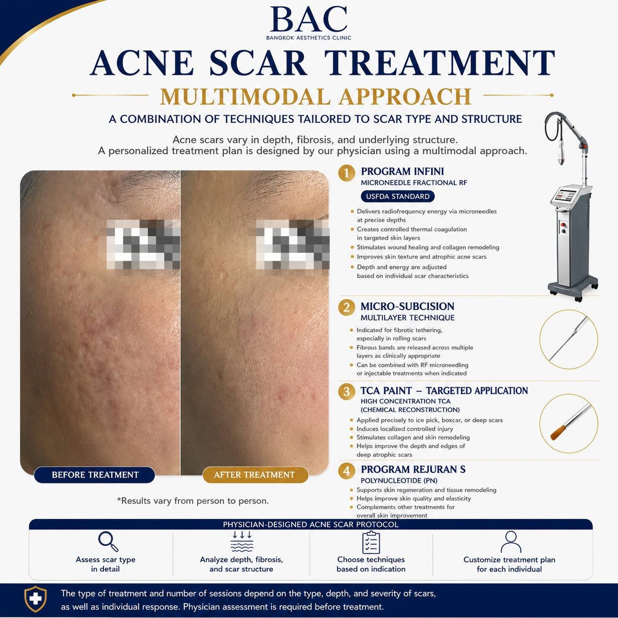 Acne Scar Treatment Bangkok