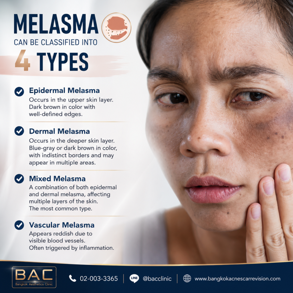melasma treatment bangkok