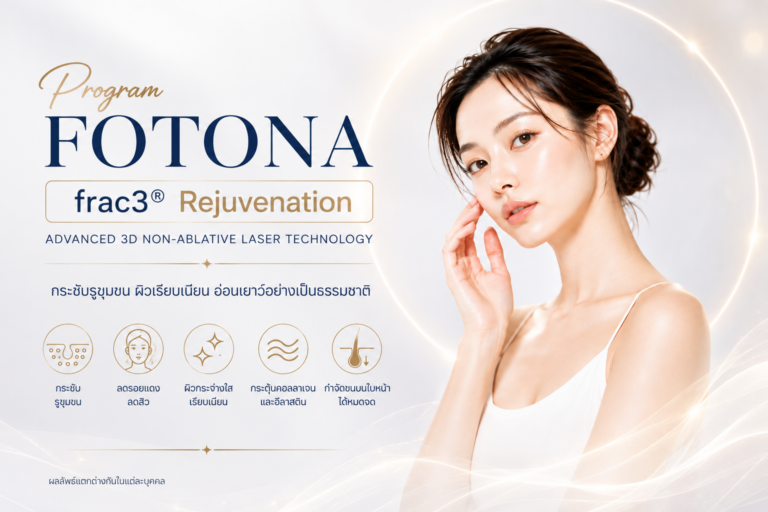 เลเซอร์กระชับรูขุมขน Program FOTONA frac3® | ลดสิวอักเสบ รอยแดง ฟื้นฟูผิว