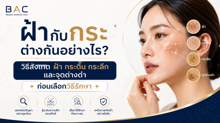ฝ้ากับกระต่างกันอย่างไร? วิธีสังเกตฝ้า กระ และจุดด่างดำ ก่อนเลือกวิธีรักษา