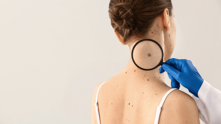 CO2 Laser Bangkok | Mole, Skin Tag & Wart Removal