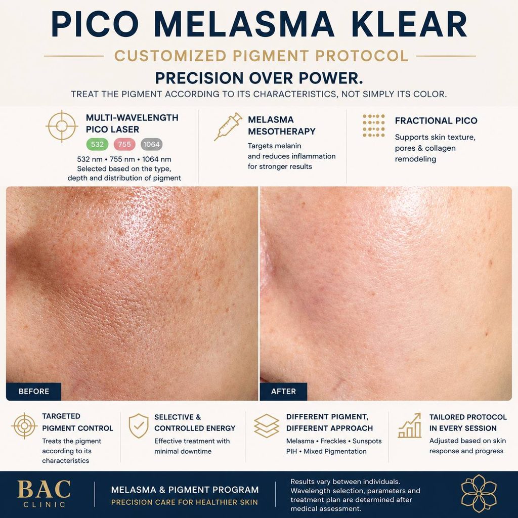 melasma treatment Bangkok