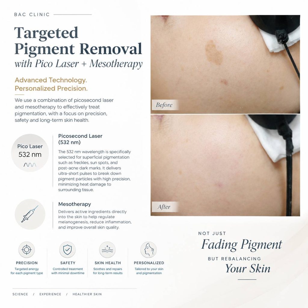 best melasma clinic Bangkok