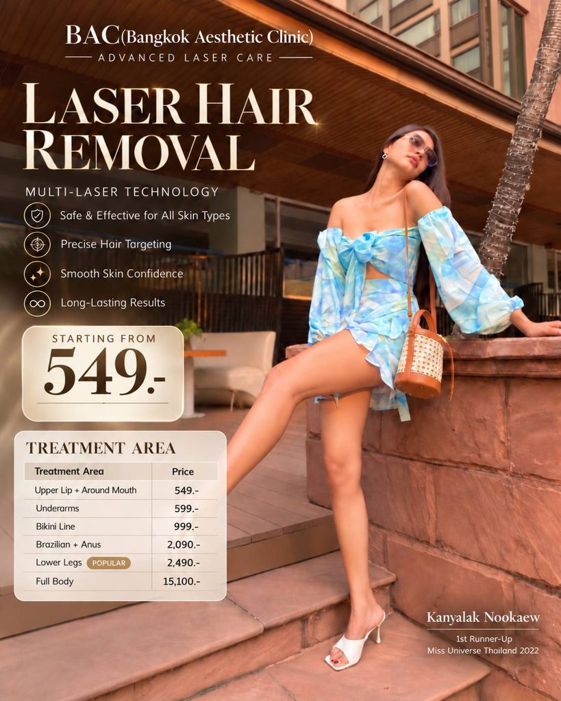 laser hair removal