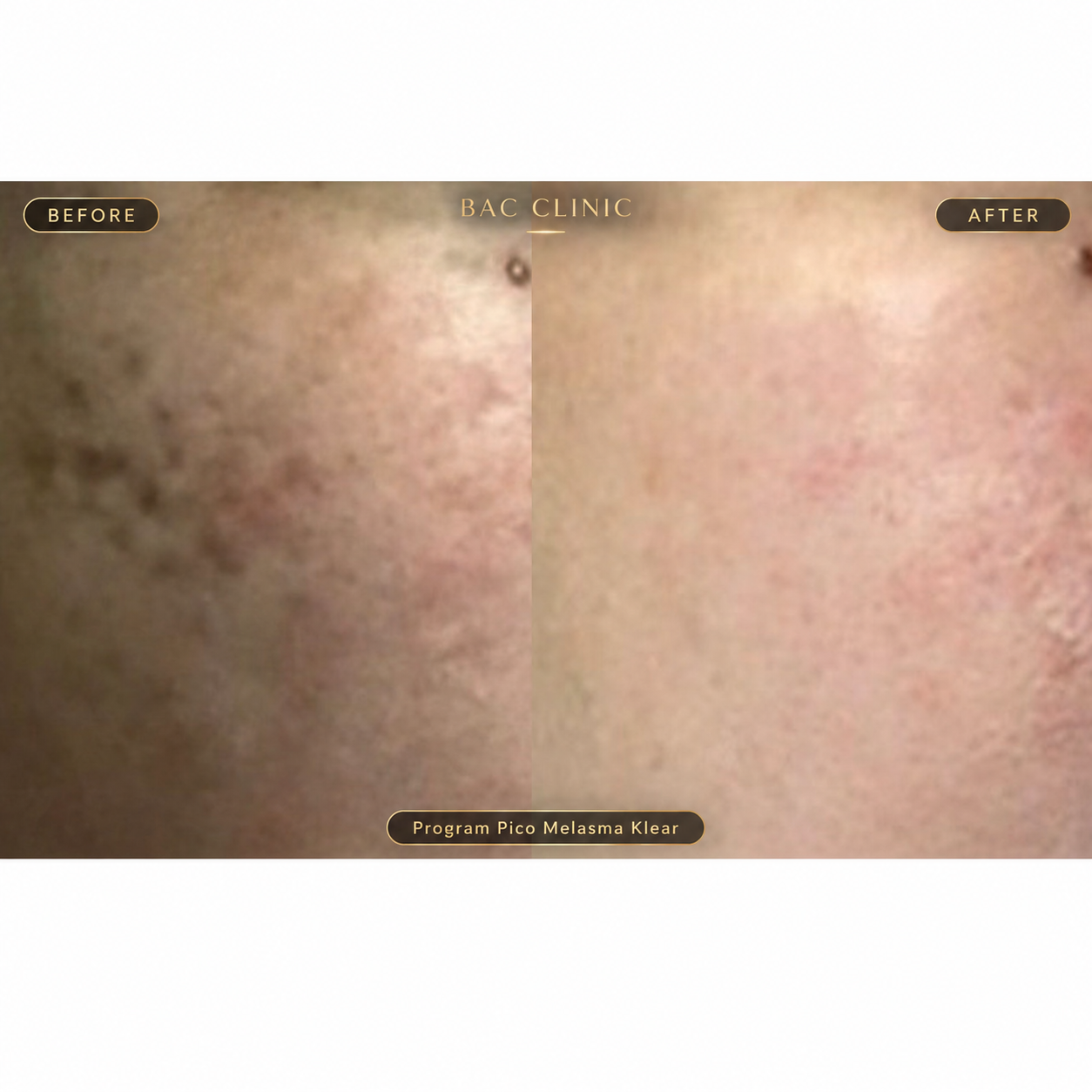 BAC Clinic treatment image 1