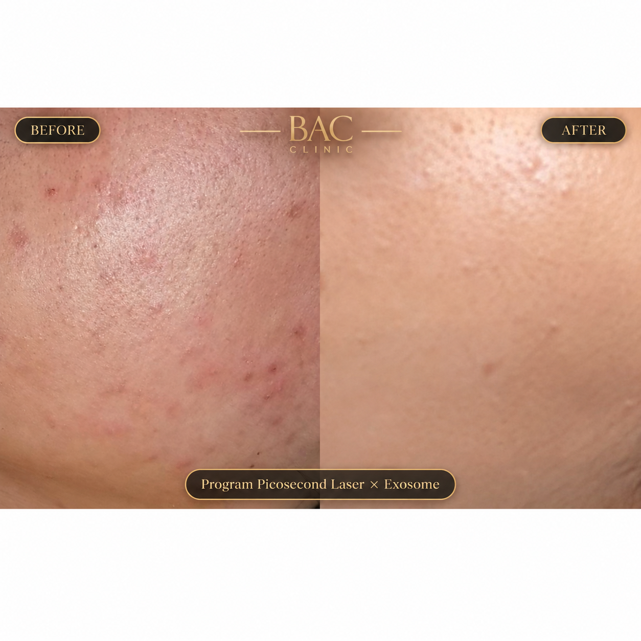BAC Clinic treatment image 3