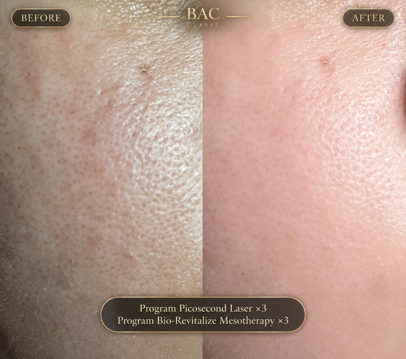 BAC Clinic treatment image 2