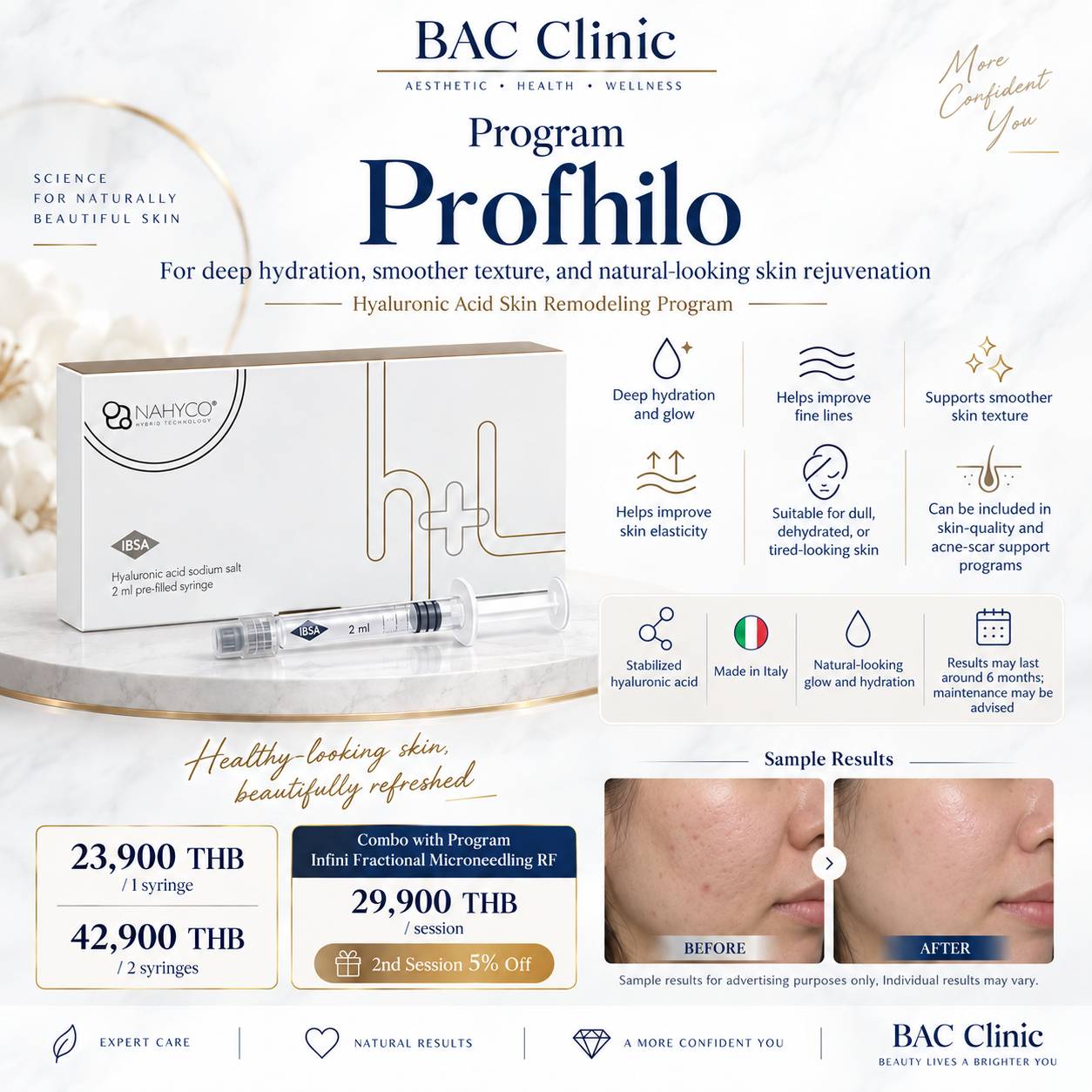 Customized acne scar treatment BAC Clinic