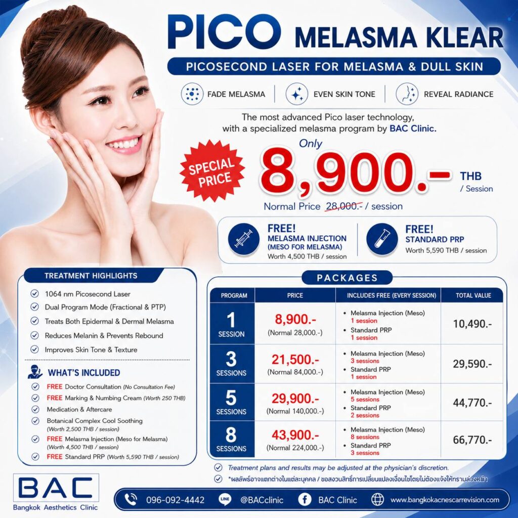 melasma treatment Bangkok